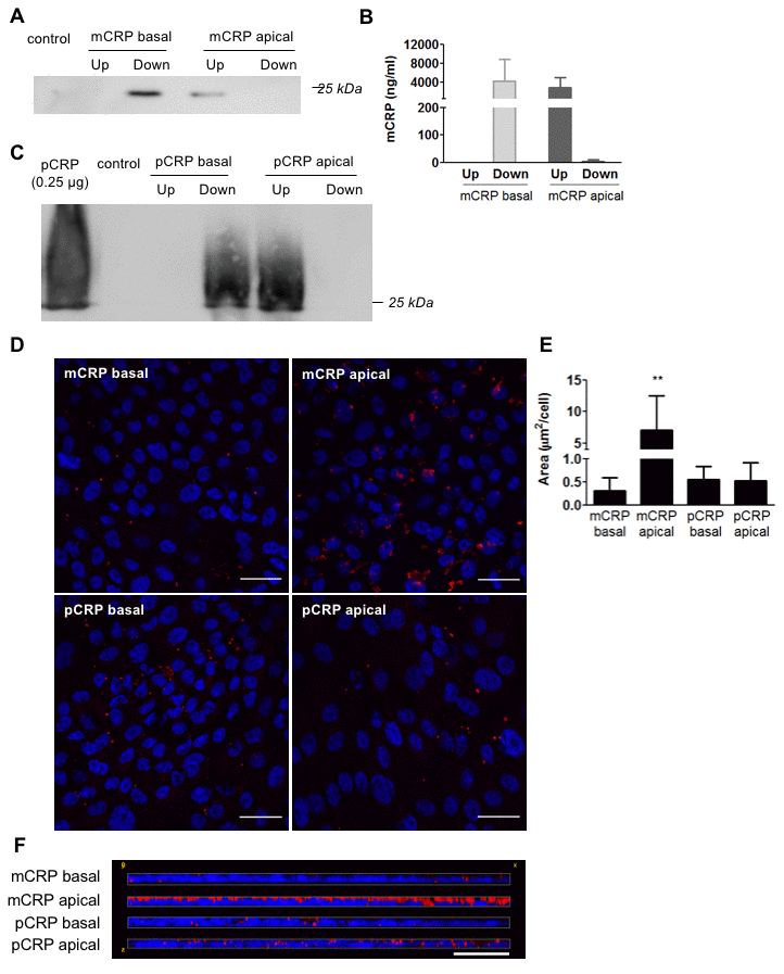 Diffusion of CRP isoforms across primary porcine RPE cells. (A) Western blot of mCRP present in apical (Up) and basolateral (Down) supernatants 48 hours after addition of mCRP (N=4). (B) ELISA of mCRP (ng/ml) from apical (Up) and basolateral (Down) supernatants. Values are expressed as mean ± SD (N=5). (C) Western blot of pCRP present in apical (Up) and basolateral (Down) supernatants 48 hours after treatment (N=3). (D) Immunofluorescence of CRP (red) stained with monoclonal antibodies against mCRP (3H12) or pCRP (1C6). Nuclei stained with DAPI. Scale bar = 30 μm (N=3). (E) Quantification of CRP binding measured as stained area divided by the number of cells per image (μm2/cell). Results are expressed as mean area (μm2/cell) ± SD. Statistical analysis was performed by One-Way ANOVA and Tukey’s posthoc. **PF) Reconstruction of x-z sections with a 0.3 μm z axis step of immunofluorescence images. Images shown are representative of three independent experiments.