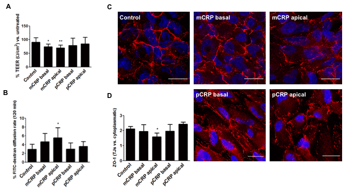 mCRP induces barrier disruption in ARPE-19 cells in a polarized manner. ARPE-19 cells were treated with CRP isoforms for 48h either from the apical side or the basolateral chamber and TEER (A) and paracellular permeability as determined by FITC-dextran diffusion rate (B) was determined. (C) Cells were then fixed and immunostained with anti ZO-1 (red) and DAPI (blue). Images shown are representative of four independent experiments. Scale bar = 20 μm. (D) Quantification of ZO-1 at the TJs expressed as relative (intercellular/cytoplasmic) ZO-1 distribution. Values are expressed as mean ± SD and statistical analysis was performed by one-way ANOVA and Dunnett´s posthoc analysis (N=4). * P