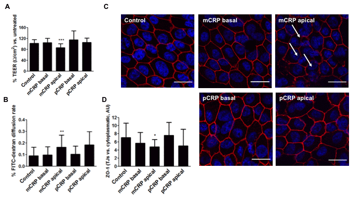 mCRP induces barrier disruption in primary porcine RPE cells in a polarized manner. Primary porcine RPE cells were treated with CRP isoforms for 48h either from the apical side or the basolateral chamber and TEER (A) and paracellular permeability as determined by FITC-dextran diffusion rate (B) was determined. (C) Cells were then fixed and immunostained with anti ZO-1 (red) and DAPI (blue). Images shown are representative of four independent experiments. Arrows show disruption of ZO-1. Scale bar = 20 μm. (D) Quantification of ZO-1 at the TJs expressed as relative (intercellular/cytoplasmic) ZO-1 distribution. Values are expressed as mean ± SD and statistical analysis was performed by one-way ANOVA and Dunnett´s posthoc analysis (N=6). * P