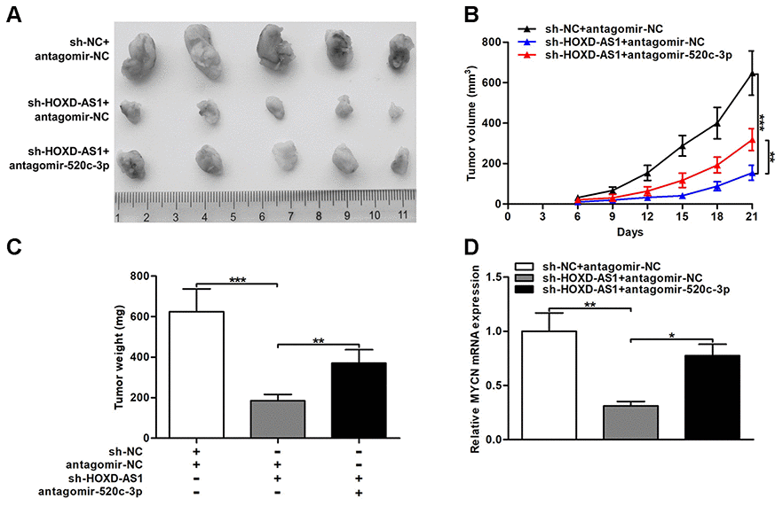 HOXD-AS1/miR-520c-3p/MYCN contributed to CCA tumorigenesis in vivo. (A) CCLP-1 cells cotransfected with sh-HOXD-AS1 and antagomir-520c-3p were subcutaneously injected into the posterior flanks of mice, and xenograft tumors were dissected on the 21st day after injection. (B) Tumor volumes were calculated every 3 days throughout the course of tumor growth. (C) Tumor weights were measured after excision. (D) MYCN mRNA expression in xenograft tumors of the three groups (sh-NC/antagomir-NC, sh-HOXD-AS1/antagomir-NC, sh-HOXD-AS1/antagomir-520c-3p). *P **P ***P 