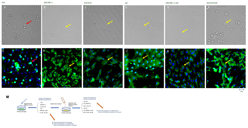 Inflammatory factors and Aβ activated primary microglia in vitro. (A–F) Microglial morphology was observed in light field images. (G–L) Microglia treated with different stimuli were stained with an anti-Iba1 antibody and observed on a fluorescence microscope. Green represents Iba1+ cells, while blue represents DAPI staining. (A, G) Control microglia. (B, H) Microglia treated with LPS/IFN-γ for 24 h. (C, I) Microglia treated with IL-4/IL-13 for 24 h. (D, J) Microglia treated with Aβ1-24 for 24 h. (E, K) Microglia treated with Aβ1-24 for 2 h, and then with LPS/IFN-γ for 24 h. (F, L) Microglia treated with Aβ1-24 for 2 h, and then with IL-4/IL-13 for 2 h. Scale bars, 25 μm. (M) Description of methods: Primary microglia were divided into six groups to be treated with different stimuli. Media from these microglia were then collected and co-cultured with primary astrocytes, and these astrocytes were divided into six groups according to the media with which they were treated. Microglial polarization was examined, and cytokine levels in both types of glia were measured.