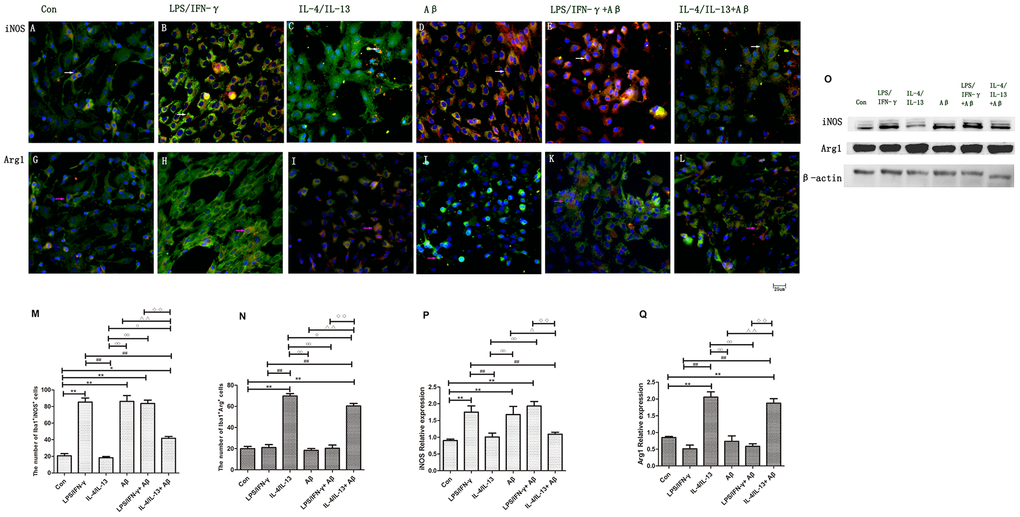 Microglial polarization was induced by inflammatory factors and Aβ. (A–F) Microglia in different groups were double-stained with anti-iNOS and anti-Iba1 antibodies and observed on a fluorescence microscope. Green represents Iba1+ cells, red represents iNOS+ cells and blue represents DAPI staining. The white arrows denote iNOS+Iba1+ cells. (G–L) Microglia in different groups were double-stained with anti-Arg1 and anti-Iba1 antibodies. Green represents Iba1+ cells, red represents Arg1+ cells and blue represents DAPI staining. White arrows denote Arg1+Iba1+ cells. Scale bars, 25 μm. (M, N) Quantitative data on the mean number of iNOS+Iba1+ or Arg1+Iba1+ cells (n=5). (O) Microglia in different groups were subjected to Western blotting to detect iNOS and Arg1. β-Actin was used as the internal control. (P, Q) Quantitative data on the relative protein levels of iNOS and Arg1 (n=3). Error bars, S.E.M. Compared with Con, *pppppppppp