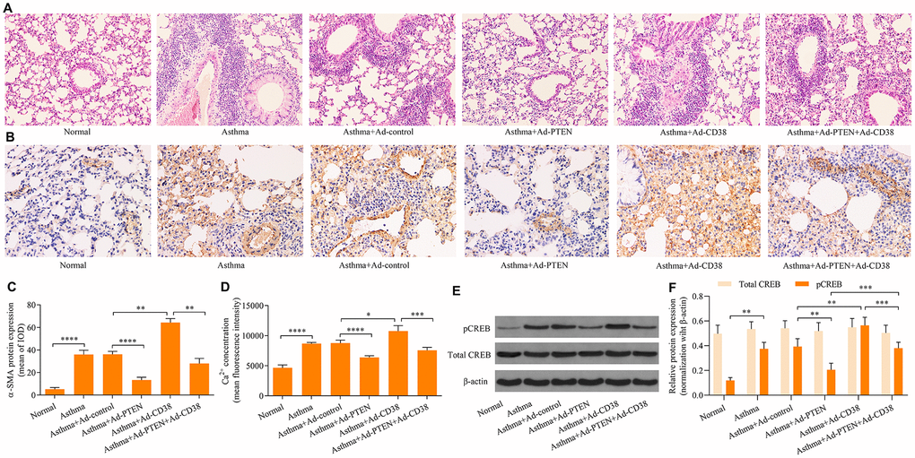 CD38 overexpression reverses PTEN-mediated suppressive effects on airway remodeling, Ca2+ induction and CREB phosphorylation in the lung tissue of asthmatic mice. (A) HE staining of lung tissues (magnification: 400X). (B, C) Detection of ASM cell mass using immunohistochemistry staining of α-SMA (magnification: 400X). (D) Intracellular Ca2+ concentrations measured via Fluo-3 AM fluorescent probes in lung tissues. (E, F) Expression of total CREB and pCREB protein levels were determined using Western blot. n = 3, *p 
