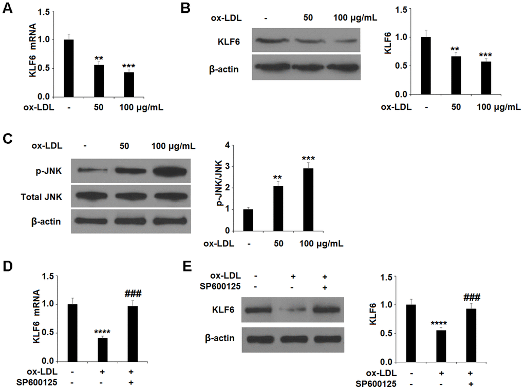 Ox-LDL reduced the expression of KLF6 mediated by JNK in HUVECs. (A, B) Cells were treated with ox-LDL (50, 100 μg/mL) for 24 h. mRNA and protein of KLF6 were measured by real-time PCR and western blot analysis respectively. (C) Cells were treated with ox-LDL (50, 100 μg/mL) for 2 h. Phosphorylated JNK was measured by western blot analysis. (D, E) Cells were treated with ox-LDL (100 μg/mL) in the presence of the JNK inhibitor SP600125 (10 μM) for 24 h. mRNA and protein of KLF6 were measured, respectively (**, ***, ****, P