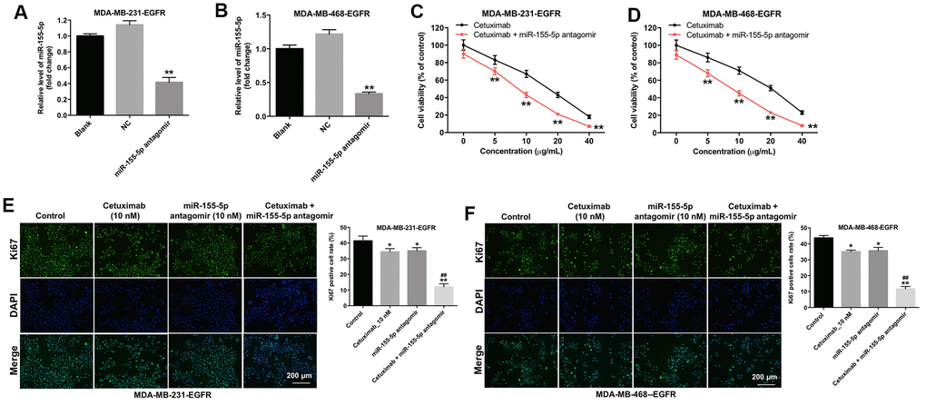 Downregulation of miR-155-5p enhances the anti-proliferative effect of cetuximab in TNBC cells. (A) EGFR-overexpressed MDA-MB-231 and (B) MDA-MB-468 cells were transfected with miR-155-5p for 72 h. RT-qPCR was used to detect the level of miR-155-5p in cells. (C) EGFR-overexpressed MDA-MB-231 and (D) MDA-MB-468 cells were treated with cetuximab (0, 5, 10, 20, or 40 nM) and/or the miR-155-5p antagomir (10 nM) for 72 h. The Cell Counting Kit-8 (CCK-8) assay was used to detect cell viability. (E) EGFR-overexpressed MDA-MB-231 and (F) MDA-MB-468 cells were treated with cetuximab (10 nM) and/or the miR-155-5p antagomir (10 nM) for 72 h. Relative fluorescence expression levels were quantified by Ki67 and DAPI staining. **P ##P 
