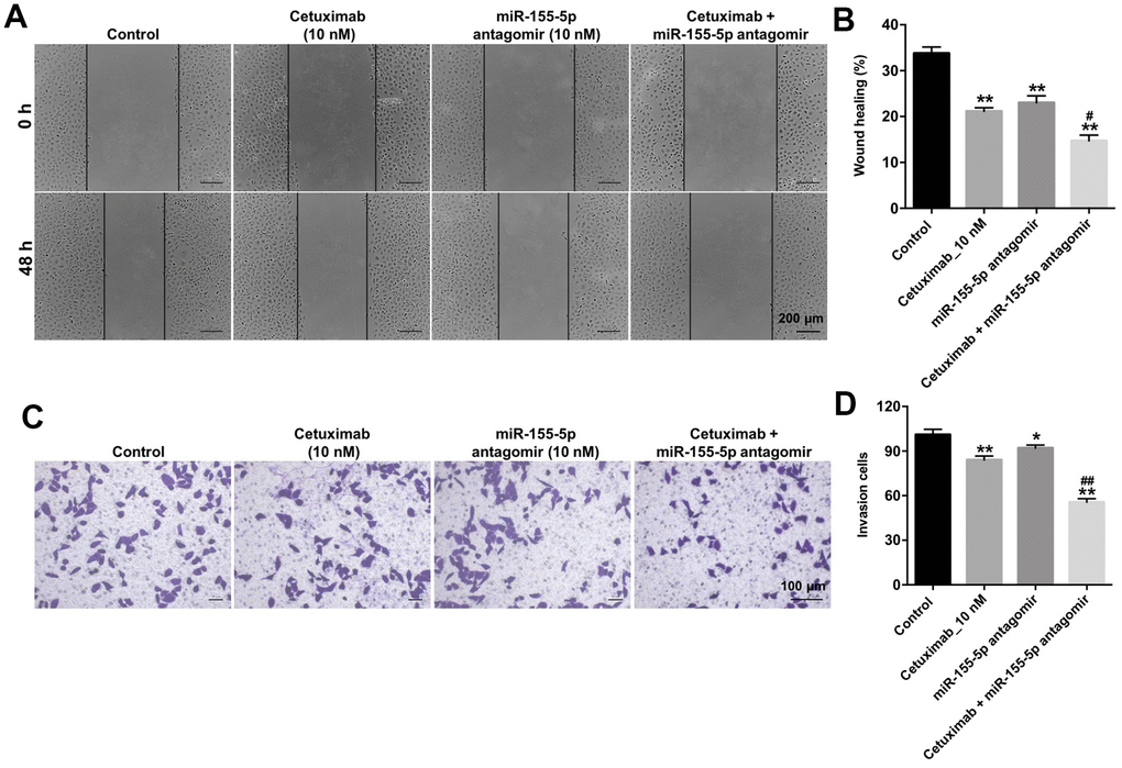 Downregulation of miR-155-5p enhances the inhibitory effect of cetuximab on the migration and invasion of TNBC cells. (A, B) EGFR-overexpressed MDA-MB-468 cells were treated with cetuximab (10 nM) and/or the miR-155-5p antagomir (10 nM) for 48 h. Cell migration was detected using the wound healing assay. (C, D) EGFR-overexpressed MDA-MB-468 cells were treated with cetuximab (10 nM) and/or the miR-155-5p antagomir (10 nM) for 24 h. Cell invasion was detected using the transwell invasion assay. *P ##P 