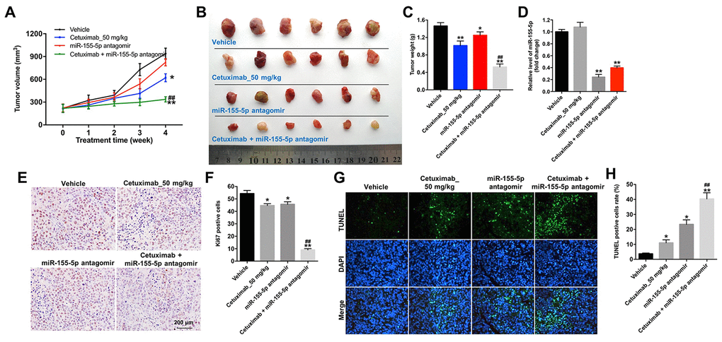 Downregulation of miR-155-5p enhances the anti-tumor effect of cetuximab in TNBC cells in vivo. EGFR-overexpressed MDA-MB-468 cells were subcutaneously injected into nude mice. (A) Tumor volumes of the mice were measured weekly. (B) The tumors were excised from xenografts and imaged on day 28. (C) The tumor weights were calculated. (D) RT-qPCR was used to determine the level of miR-155-5p in the tumor tissues. (E, F) The number of Ki67 positive cells in tumor tissues was measured using an immunohistochemistry (IHC) analysis. (G, H) The cell apoptosis in tumor tissues was measured using a TUNEL analysis. *P ##P 