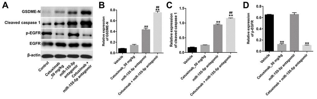 Downregulation of miR-155-5p enhances the anti-tumor effect of cetuximab in TNBC cells in vivo via inducing pyroptosis. (A) The expression levels of GSDME-N, cleaved caspase-1 and p-EGFR in tumor tissues were detected by Western blotting. (B, C) The relative expression levels of GSDME-N and cleaved caspase-1 in tumor tissues were normalized to β-actin. (D) The relative expression of p-EGFR in tumor tissues was normalized to EGFR. **P ##P 