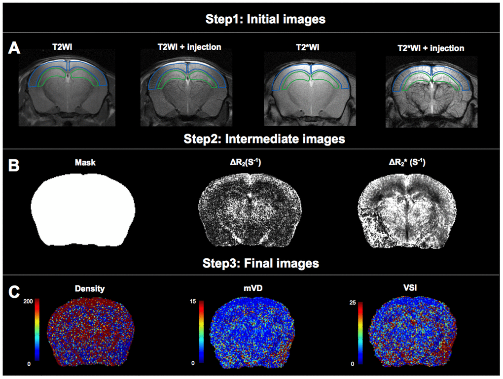 Analysis of microvascular density (Density), mean vessel diameter in the voxel (mVD), and vessel size index (VSI). (A) The first step of data processing. Two regions of interest (ROIs) were delineated on T2WI and projected to other images. The ROI delineated by the blue line is cortical region, and the ROI delineated by the green line is hippocampal region. (B) The second step of data processing. Maps of mask, ΔR2 and ΔR2* obtained from intermediate steps of data processing. (C) The third step of data processing. Colormaps of Density, mVD and VSI of obtained images.