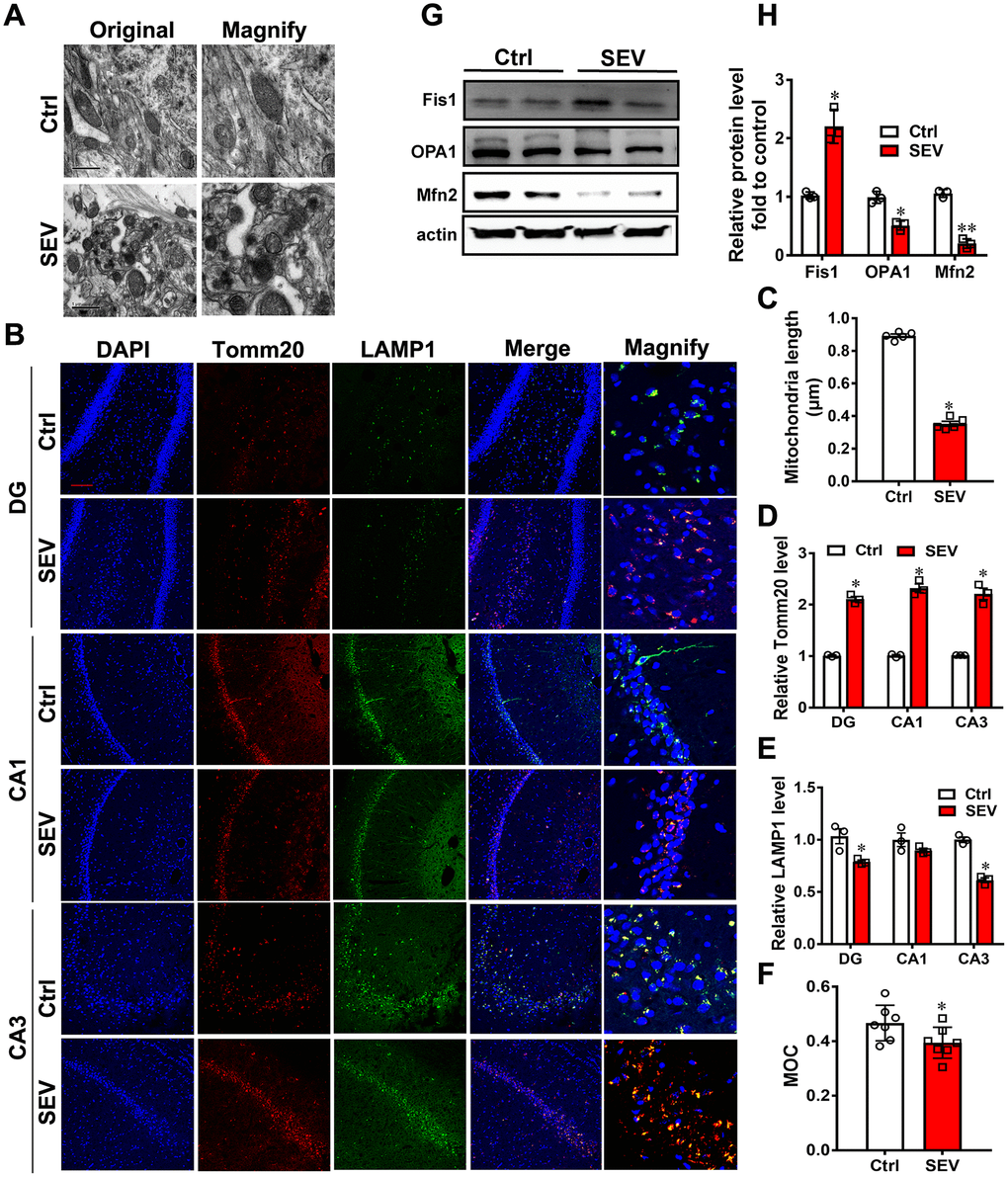 Sevoflurane induced mitochondria impairment in vivo. Eighteen-month-old rats were subjected to 2% sevoflurane for 5 h (SEV). After perfusion, the ultrastructure of mitochondria in the hippocampus was observed under an electron microscope. (A) The lengths of all mitochondria were measured and are shown in (C) Tomm20 and LAMP1 protein levels in the hippocampus were measured by immunofluorescence assay. Scale bar represents 50 μm. (B) The levels of Tomm20 are shown in (D) and LAMP1 in (E) Manders’ overlap coefficient (MOC) was calculated to determine the degree of colocalization. (F) The proteins Fis1, OPA1 and Mfn2 were examined by western blotting. (G) The results of semi-quantitative analysis of Fis1, OPA1, Mfn2 and β-actin are shown in (H) Images show representative examples from three independent experiments for each group. The data are expressed as mean ± SD. (C-R) * PP