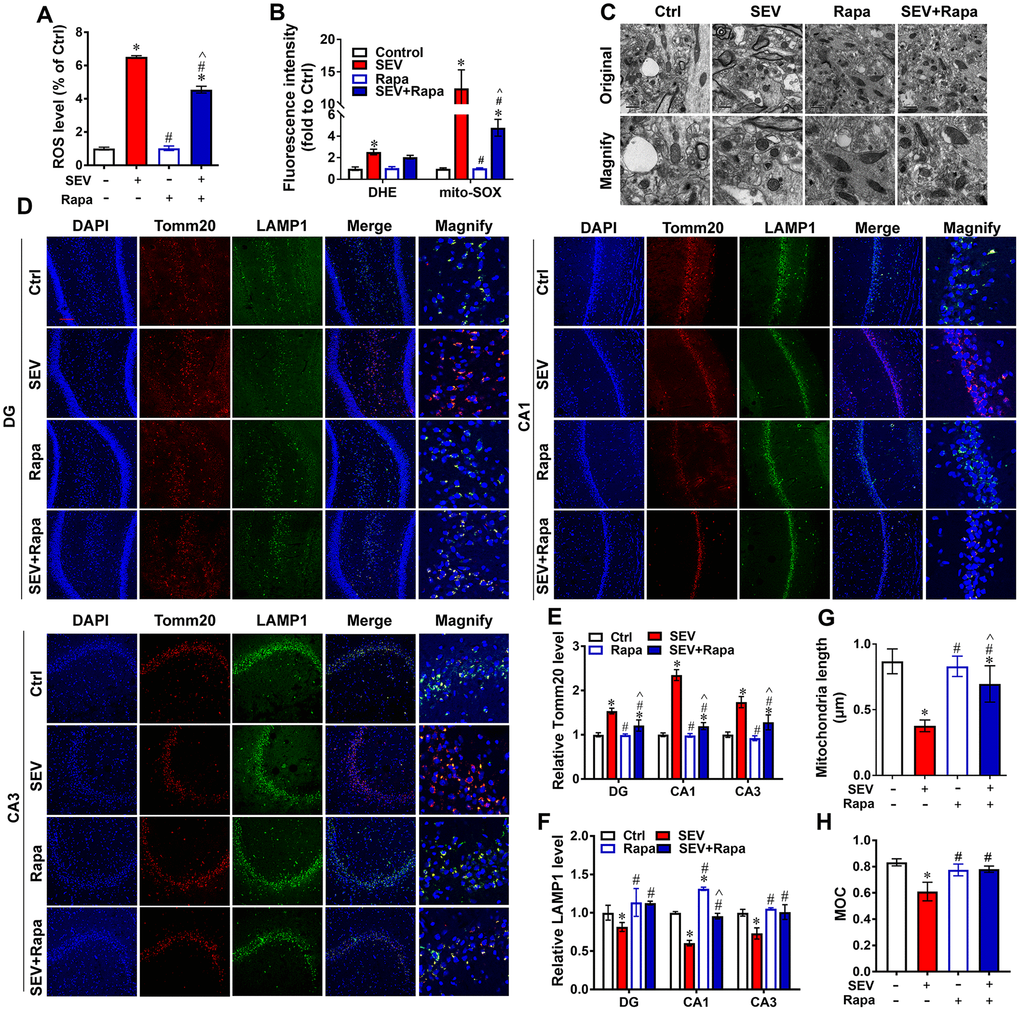 Rapamycin relieved sevoflurane-induced mitochondria impairment. H4 cells were exposed to 0% sevoflurane with rapamycin (1μmol/L) (Rapa), 4.1% sevoflurane without rapamycin (SEV), 4.1% sevoflurane with rapamycin (SEV+Rapa), or 0% sevoflurane without rapamycin (Ctrl) for 6 h, and the ROS level (A) and intracellular ROS and mitochondrial ROS levels (B) were measured. Eighteen-month-old rats were subjected to 2% sevoflurane (SEV and SEV+Rapa groups) for 5 h. Rapamycin (20 mg/kg/d) was administrated intraperitoneally two days before sevoflurane treatment, and daily administrations were continued for one week (Rapa and SEV+Rapa groups). After perfusion, the ultrastructure of mitochondria in the hippocampus was observed under an electron microscope. (C) The lengths of all mitochondria were measured. (G) The Tomm20 and LAMP1 protein levels were measured by immunofluorescence assay. Scale bar represents 50 μm. (D) The results of Tomm20 (E) and LAMP1 (F) quantification are shown. The Manders’ overlap coefficient is shown in (H). Images show representative examples from three independent experiments for each group. The data are expressed as mean ± SD. *PPP