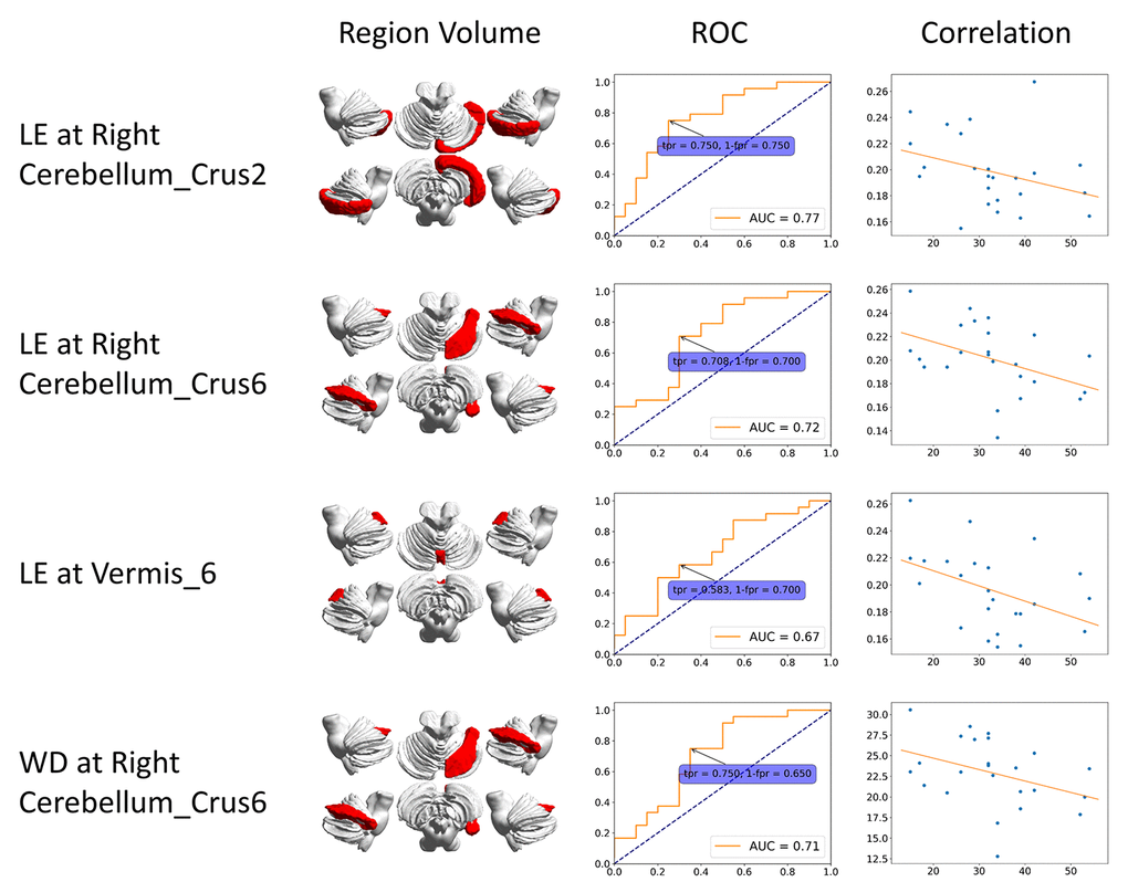 ROC curve and correlation of static features. The correlation is between clinical score (x-axis) and features (y-axis). BC: betweenness centrality; CCFS: clustering coefficient; LE: local efficiency; WD: weighted degree.