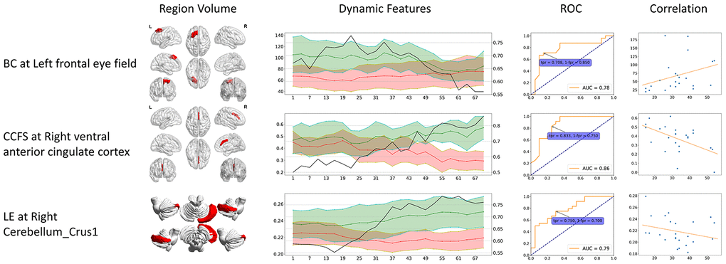 Dynamic specific significant features. These significant features can only be identified from dynamic functional connectivity. The 3D region volume was shown, as well as the dynamic features line plots. Green stands for healthy controls, red stands for CMSA patients (value on the left axis), and black line stands for ROC AUC (value on the right axis). The ROC curve at the time point when AUC reached its maximum is shown. The correlation is between clinical score (x-axis) and features (y-axis). BC: betweenness centrality; CCFS: clustering coefficient; LE: local efficiency; WD: weighted degree.