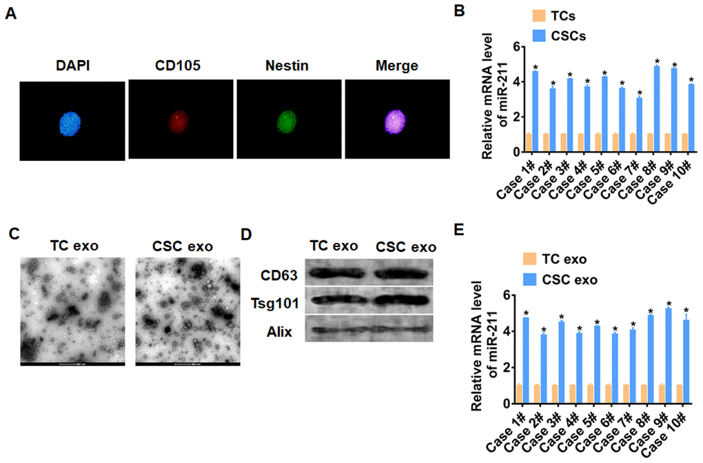 CSCs secreted exosomal miR-211 in NSCLC. (A) Immunofluorescence staining for CD105 and Netin expression of CSCs 3D sphere. DAPI indicates nucleus. Scale bar = 20 μM. (B) qRT-PCR analyzed the expression of miR-211 in TCs and CSCs. n=6, *pC) TEM of exosomes isolated from TC and CSC. Scale bar = 500 nM. (D) Western blot for CD63, Tsg101 and Alix in exosomes. (E) The expression of miR-211 in exosomes was tested by qRT-PCR. n=6, *p