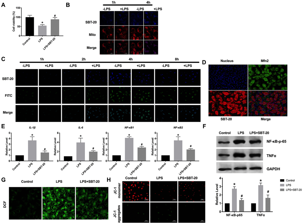 The location and effect of SBT-20 in mitochondrial. (A) MTT assay was carried out to assess the cell viability. n=10. (B) Representative diagram of cellular uptake of SBT-20. (C) Representative diagram of colocalization of SBT-20 with FITC. (D) Representative diagram of colocalization of SBT-20 with Mfn2. (E) The mRNA level of inflammatory-associated cytokine IL-1β, IL-6, NF-κB1 and NF-κB2 in different group. n=7. (F) The protein level of NF-κB-p65 and TNFα. (G) The ROS production was measured in cells. n=5. (H) Detection of mitochondrial membrane potential. (*Pvs. control group, #Pvs. LPS group).