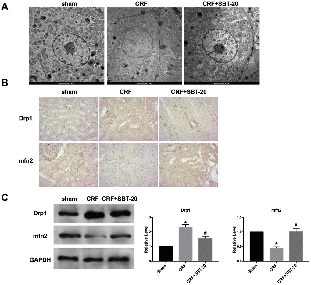 SBT-20 protect mitochondria protection in vivo. (A) Transmission electron microscope image of mitochondria in outer medulla. (B) Representative image of Immunohistochemistry (IHC). (C) The protein expression of Drp1 and Mfn2 in renal tissues. n=5. (*Pvs. sham group, #Pvs. CRF group).