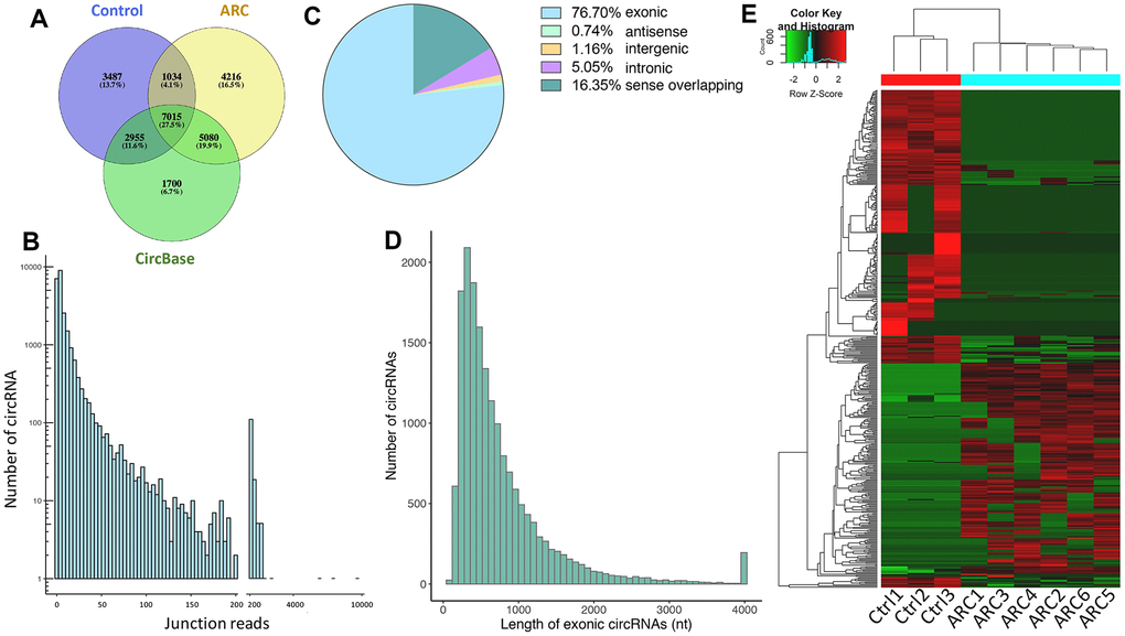 Total circRNAs detected by RNA-seq in ARC and normal tissues. (A) Overlaps of circRNAs identified in this study (ARC and the normal group) and CircBase. (B) The number of circRNAs and junction reads identified in ARC and normal tissues. (C) The genomic location of circRNAs. (D) The length distribution of exonic circRNAs. (E) The hierarchical clustering of circRNAs differentially expressed in ARC and normal tissues. Each row corresponds to a circRNA, and each column corresponds to a sample. The expression value is represented by a color scale. Intensity increases from green (relatively low expression) to red (relatively high expression).