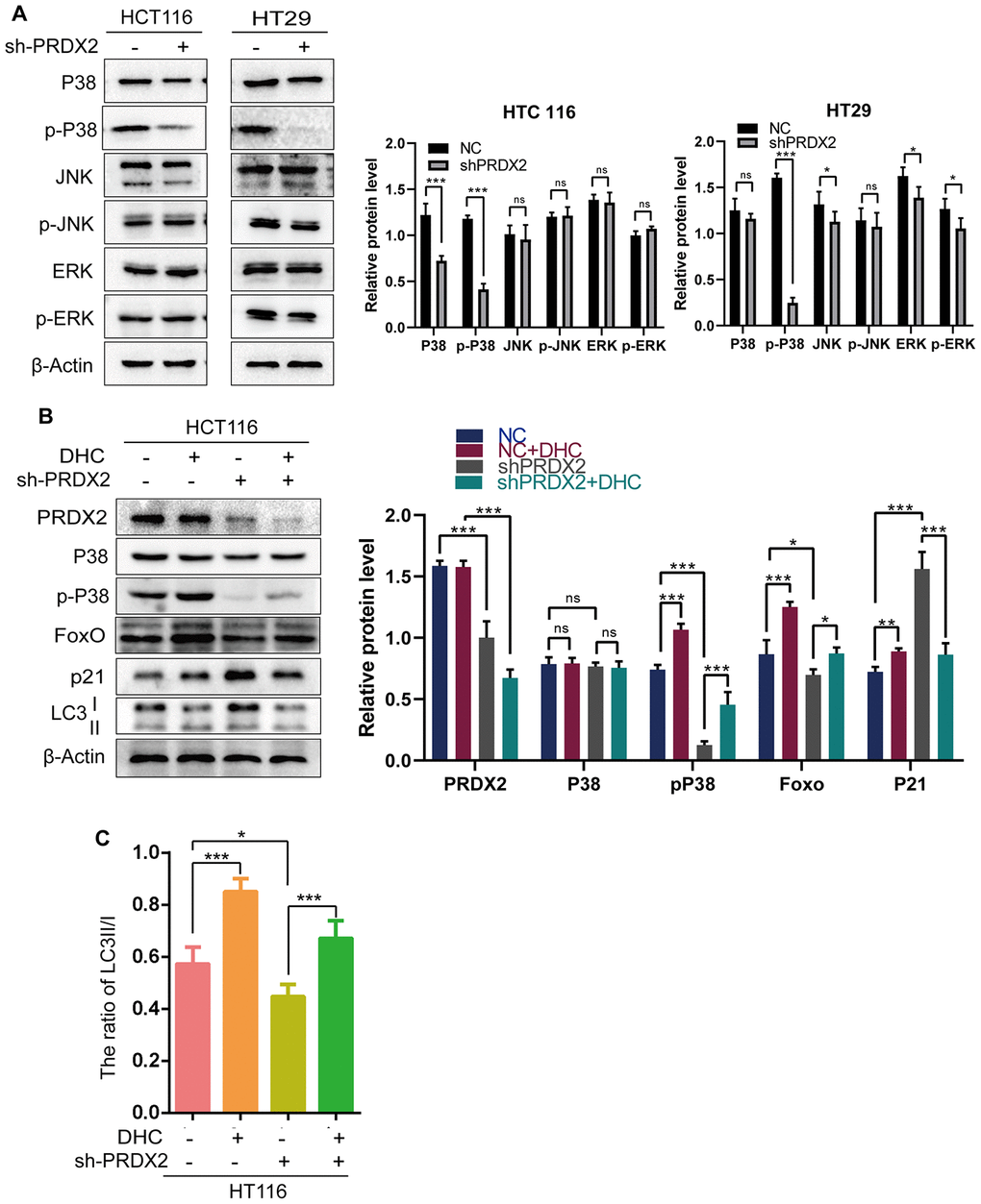 The effects of PRDX2 on the cell cycle and autophagy are mediated by the P38 pathway. (A) Western blots of MAPK signaling-related proteins. (B) Western blots of proteins related to the P38 pathway (P38 and p-P38), cell-cycle regulation (P21) and autophagy (LC3B) in sh-PRDX2 and control CRC cells with or without exposure to DHC (1 μM) for 24 h. (C) The ratio of LC3 II/I. The data are shown as the mean ± SD of three experiments. *P P P 