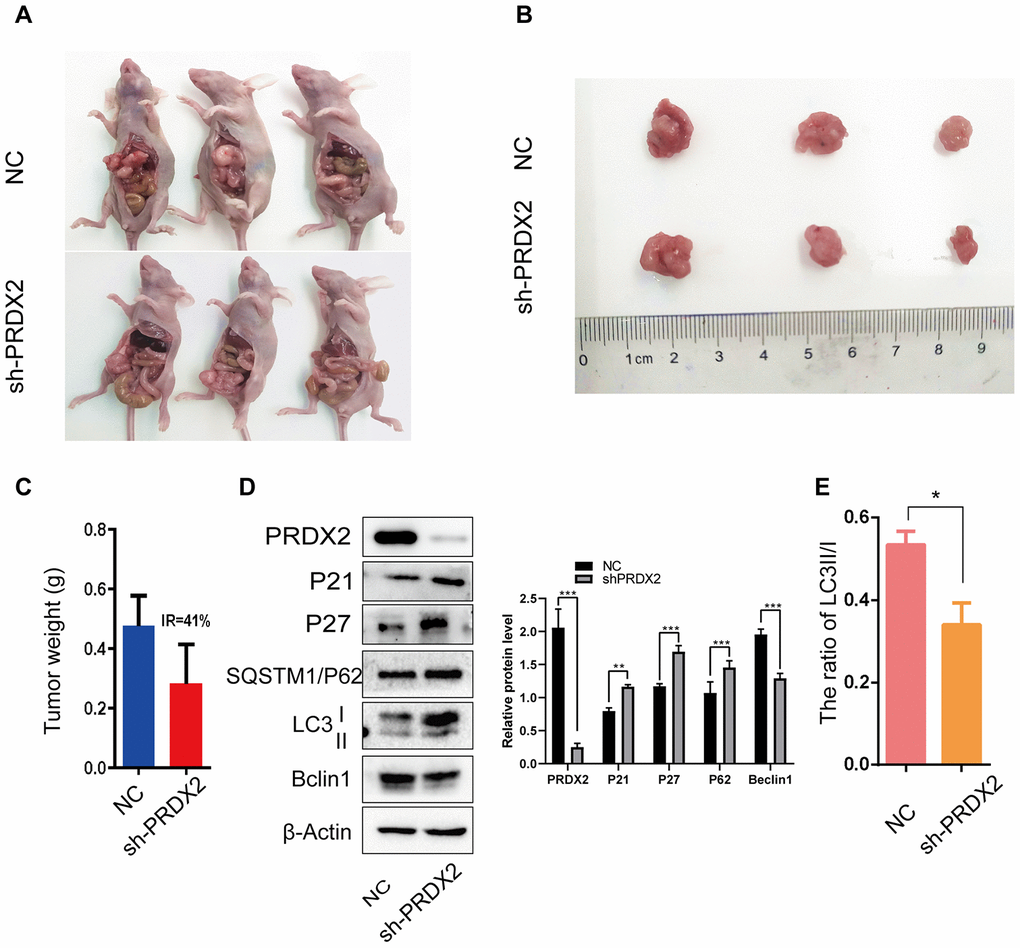 Sh-PRDX2 inhibits cell-cycle arrest and autophagy flux in vivo. (A) NC and sh-PRDX2 cells were transplanted in the mesenteric artery at the distal end of cecum of mice for 4 weeks. (B) The tumors were excised from the mesenteric artery. (C) Tumor weights were measured. IR: the tumor growth inhibition rate = (the average tumor weight of NC group - the average tumor weight of sh-PRDX2 group) / the average tumor weight of NC group. (D) Western blots of cell-cycle (left) and autophagy-related (right) proteins expressed in tumor cells. (E) The ratio of LC3 II/I. The data are shown as the mean ± SD . *P P P 