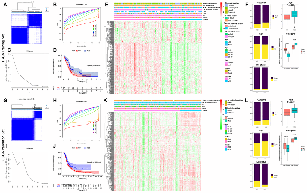 Identification and validation of the GDRG-based classification of GBM patients. Consensus clustering matrix for k = 2, which was the optimal cluster number in the TCGA training cohort (A) and CGGA validation cohort (G). (B and H) CDF curves of the consensus score (k = 2-9) in the TCGA and CGGA cohorts. (C and I) Relative change in the area under the CDF curve (k = 2-9) in the TCGA and CGGA cohorts. Kaplan-Meier survival analyses of the patients with MC1 and MC2 GBMs in the TCGA (D) and CGGA (J) cohorts, indicating that the patients with MC1 GBMs had poorer OS than those with MC2 GBMs. Heatmap and clinicopathological features of the two MCs in the TCGA (E) and CGGA (K) cohorts showing that the expression levels of the type I GDRG metagene were significantly higher and the levels of the type II GDRG metagene were significantly lower in patients with MC1 GBMs than in patients with MC2 GBMs. (F and L) Comparisons of the clinicopathological variables and type I and II metagenes between the two MCs of GBM patients in the TCGA and CGGA cohorts.