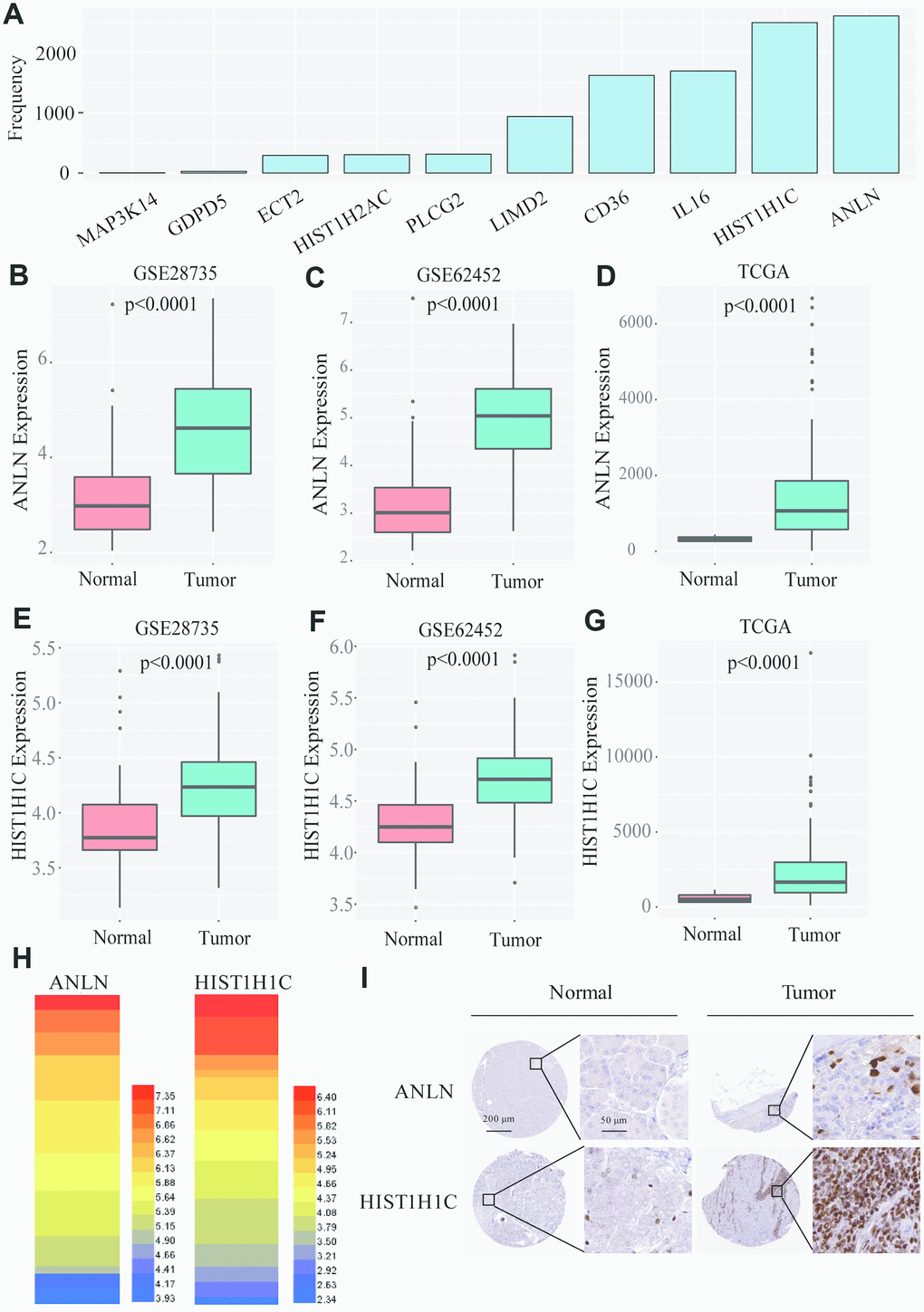 Screening of the two-gene-based signatures in PC patients. (A) After 3000 analyses, ANLN and HIST1H1C appeared more than 2500 times as the independent prognostic genes among 35 survival related genes. (B–D) The boxplot shows that ANLN were constantly high-expressed in GSE28735, GSE62452 and TCGA. (E–G) The boxplot shows that HIST1H1C were constantly high-expressed in GSE28735, GSE62452 and TCGA. (H) The heatmap of ANLN and HIST1H1C mRNA expression in PC cells from Cancer Cell Line Encyclopedia. (I) the Human Protein Atlas project shows representative immunohistochemical images of ANLN and HIST1H1C in PC tissues compared with surrounding normal tissues.