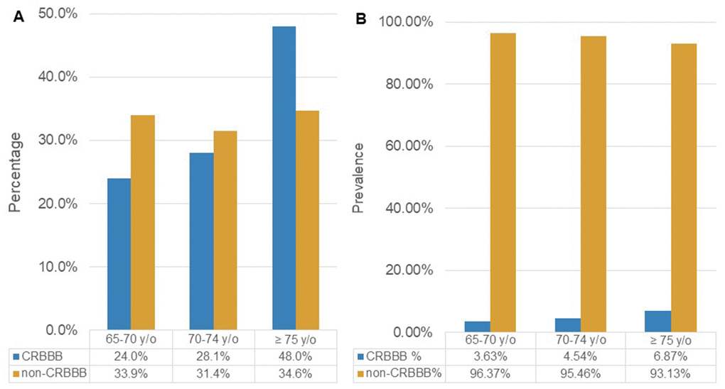 (A) The age distribution among patients with and without CRBBB. (B) Prevalence of CRBBB and non-CRBBB in each age group. (Abbreviation: CRBBB, complete right bundle branch block).