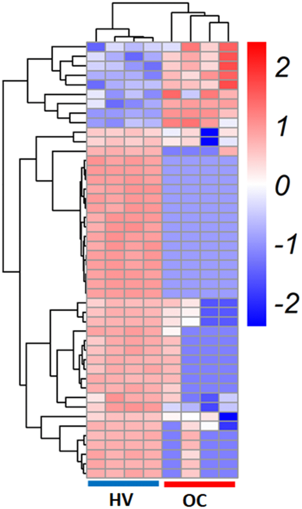 Identification of circRNAs in the serum exosomes from healthy volunteers (HV) and ovarian cancer (OC) patients. Heatmap of circRNAs in serum exosomes from HV and OC patients.