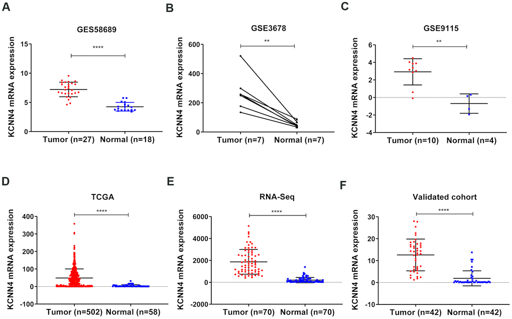 KCNN4 was overexpressed in PTC. (A–D) KCNN4 mRNA levels were greater in PTC tissues than in normal thyroid tissues in GSE58689, GSE3678, GSE9115 and TCGA. (E) KCNN4 was upregulated in 70 PTC tissues compared with matched adjacent nontumorous thyroid tissues from our RNA sequencing dataset. (F) The overexpression of KCNN4 in PTC was verified in our validated cohort using qRT-PCR. Statistical analyses were performed as follows: (A, C, D): Mann-Whitney test; (B): Paired t-test; (E, F): Wilcoxon test. **pp