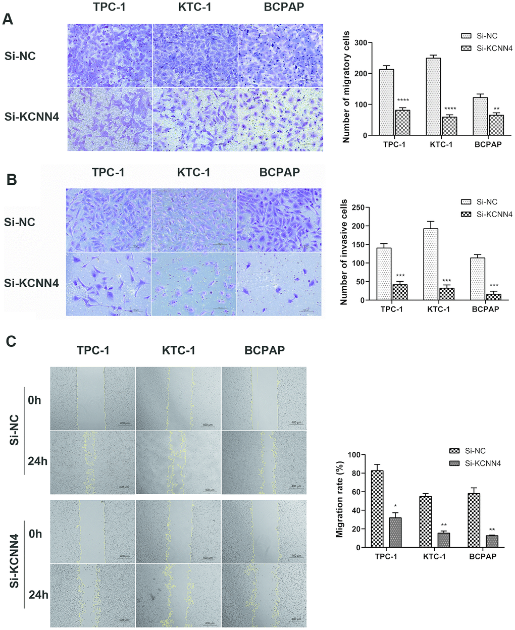 Downregulation of KCNN4 inhibited the migration and invasion of PTC cell lines. (A, B) Transwell migration and Matrigel invasion assays in the KCNN4-knockdown group and the corresponding control group in three PTC cell lines. The quantitative results of the migration and invasion assays were determined from five random fields. (C) A wound-healing assay indicated that downregulating KCNN4 reduced the migration abilities of PTC cell lines. The data came from at least two independent experiments. *pppp