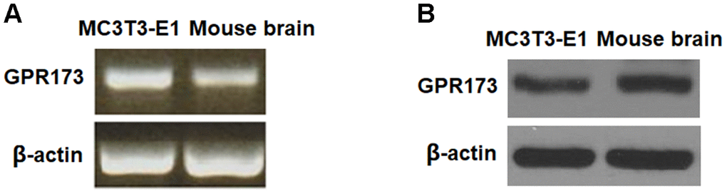 GPR173 is expressed in MC3T3-E1 cells. The expression of GPR173 was measured using mouse brain as a reference. (A) RT-PCR of GPR173; (B) Western blot of GPR173. Experiments were repeated for 3 times.