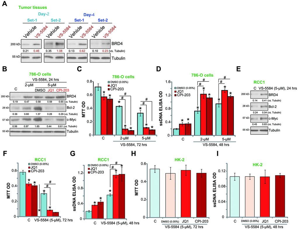 BRD4 inhibition potentiates VS-5584-induced RCC cell death and apoptosis. The 786-O xenograft tumor-bearing nude mice were administrated with vehicle control or VS-5584 (20 mg/kg, oral administration, daily), at treatment Day-2 and Day-4, 4 h after the VS-5584 or vehicle administration, two tumors (“Set-1/Set-2”) of each group were isolated, expression of BRD4 and Tubulin in tumor lysates was shown (A). 786-O cells (B) and primary human RCC cells (“RCC1”, E) were treated VS-5584 (or plus BRD4 inhibitors, B) for 24 h, listed proteins in total cell lysates were tested by Western blotting. 786-O cells (C, D), RCC1 primary cancer cells (F, G) or HK-2 cells (H, I) were pretreated with JQ1 (500 nM) or CPI203 (500 nM) for 30 min, followed by VS-5584 (2/5 μM) treatment for 48/72 h, cell survival and apoptosis were tested by MTT (C, F, H) and ssDNA ELISA (D, G, I), respectively. The listed proteins were quantified (B, E). Data were presented as mean ± standard deviation (SD, n=5). *pvs. “C” group. #p