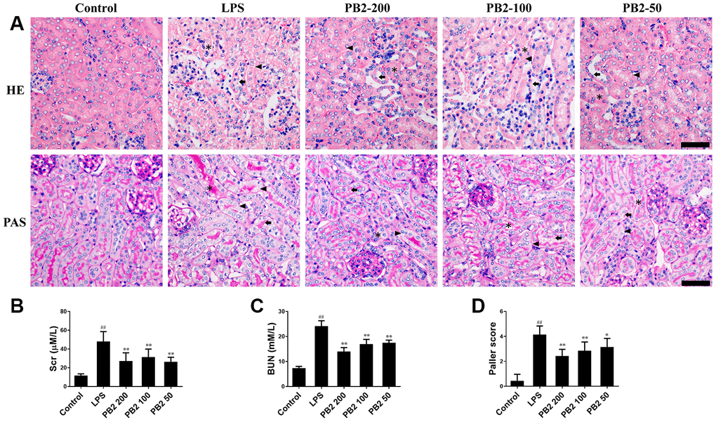 Effects of PB2 on pathological changes and renal function (n = 8). Mice were challenged with 10 mg/kg LPS (i.p.) and treated with PB2 (i.g.). 24 h after LPS challenged, mice were sacrificed. HE and PAS (Bar = 50 μm; asterisks: cast, arrowhead: vacuolization, arrow: loss of brush border) (A) and Quantification of tubular injury (D); Serum creatinine (B), Blood urea nitrogen (C). #P ##P ≤ 0.01 compared to control mice; *P ≤ 0.05, **P ≤ 0.01 compared to LPS challenged alone.