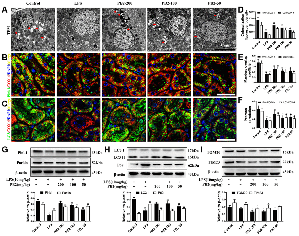 Effects of PB2 on mitophagy (n = 8). Mitochondrial structure in renal tubular epithelial (Bar = 5 μm) (A); co-localization of anti-LC3 (green)/anti-COX IV (red) antibodies (B) and anti-Pink1 (green)/anti-COX IV (red) antibodies (C) (Bar = 25 μm); the co-localization fluorescence intensity, overlap coefficient and Pearson's correlation of LC3-COX IV and Pink1-COX IV (D–F); expression of Pink1, parking, LC3 and p62, and semi-quantification (G–I). #P ≤ 0.05, ##P ≤ 0.01 compared to control mice; *P ≤ 0.05, **P ≤ 0.01 compared to LPS challenged alone.