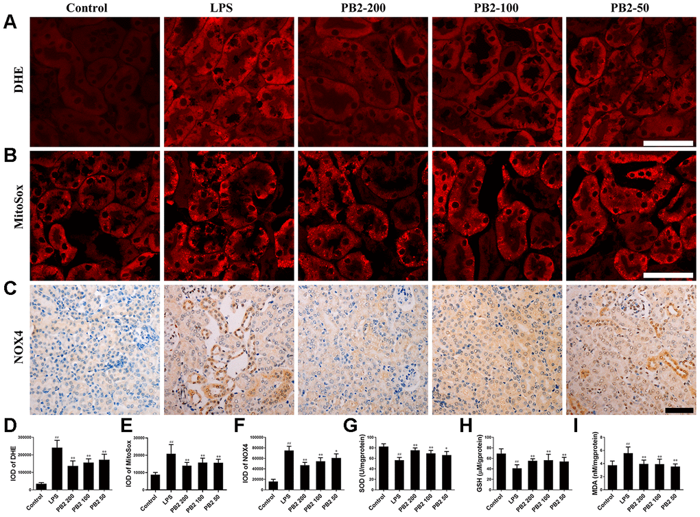 Effects of PB2 on reactive oxygen species (n = 8). DHE (A and D), MitoSox red (B and E), NOX4 (C and F) (Bar = 50 μm); The levels of SOD (G), reduce GSH (H) and MDA (I) in renal tissue. #P ≤ 0.05, ##P ≤ 0.01 compared to control mice; *P ≤ 0.05, **P ≤ 0.01 compared to LPS challenged alone.