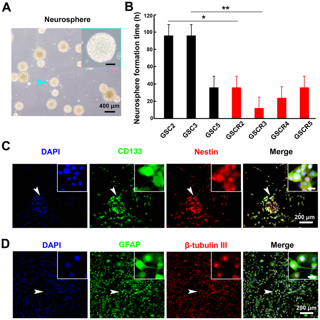 Patient glioma-derived stem cells formed neurosphere-like colonies and demonstrated characteristics of NSCs. (A) Morphology of typical primary neuorspheres derived from GBM tissues. The scale bar in high-magnification images (cyan arrow pointed region in low-magnification image) represent 50 μm. (B) The neurosphere formation time on different GSCs. Five primary and paired recurrent GBM tissues were obtained and cultured for at least 7 d. Neurospheres from 4 recurrent and 3 primary GBMs were formed. The recurrent GSCs showed higher formation ability compared with the primary GSCs (*: P P C) Immunofluorescent staining of primary tumor spheres with stem cell markers (CD133 [green]) and Nestin [red]) confirmed stemness of neurospheres. (D) The neurospheres were cultured in differentiation medium for 7 d, and differentiation markers (GFAP [green] and beta-tubulin III [red]) were immunofluorescence-stained. The obtained neurospheres maintained the typical multipotency ability. The scale bar in high-magnification images (white arrow in low-magnification images) represents 20 μm.