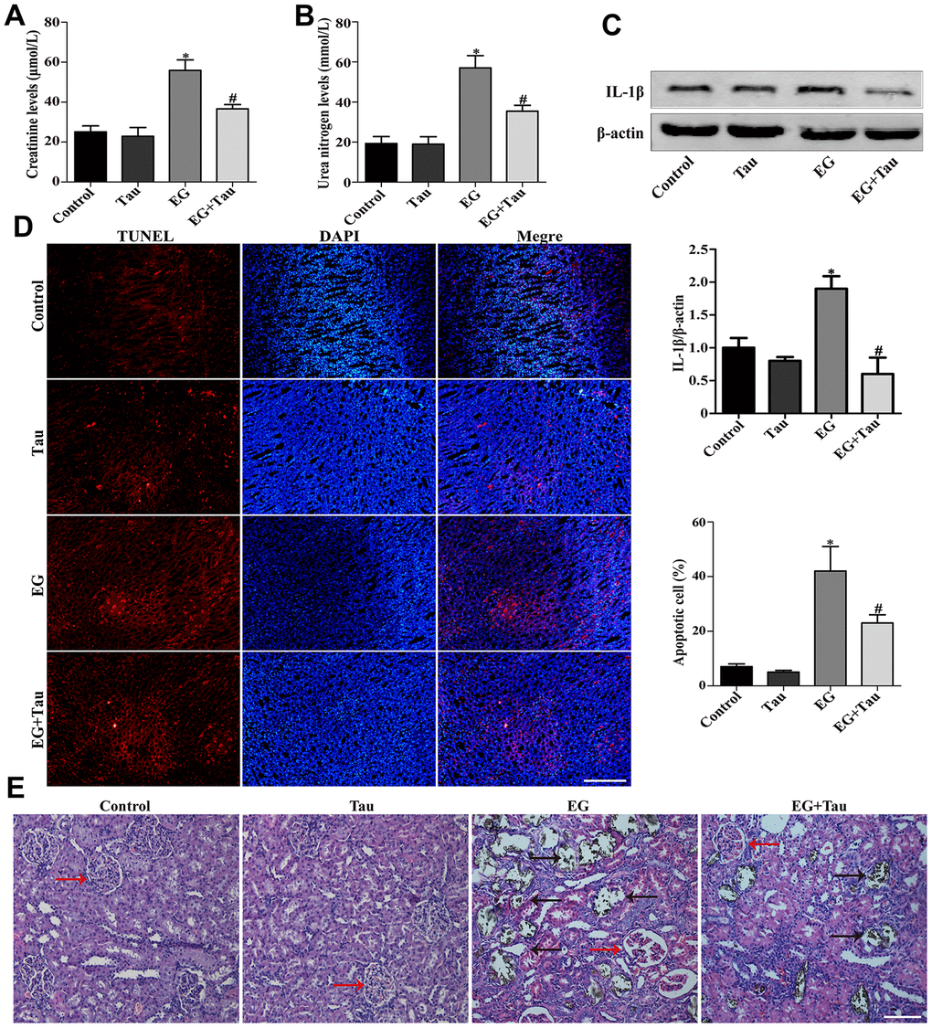 Tau attenuates EG-induced renal damage and crystal deposition in rat kidneys. (A) Effect of Tau on the serum expression of creatinine after EG-induced renal injury. (B) Effect of Tau on urea nitrogen following EG-induced renal injury. (C) Representative immunoblot and quantification analysis of IL-1β expression. (D) Renal tissue apoptosis was assessed by TUNEL staining; scale bar: 200 μm. (E) Kidney injury and crystal deposition were determined using Von Kossa-staining. Red and black arrows indicate glomerulus and crystal deposition, respectively; scale bar: 200 μm. Data are presented as the mean ± SD (n=3).*P #P 