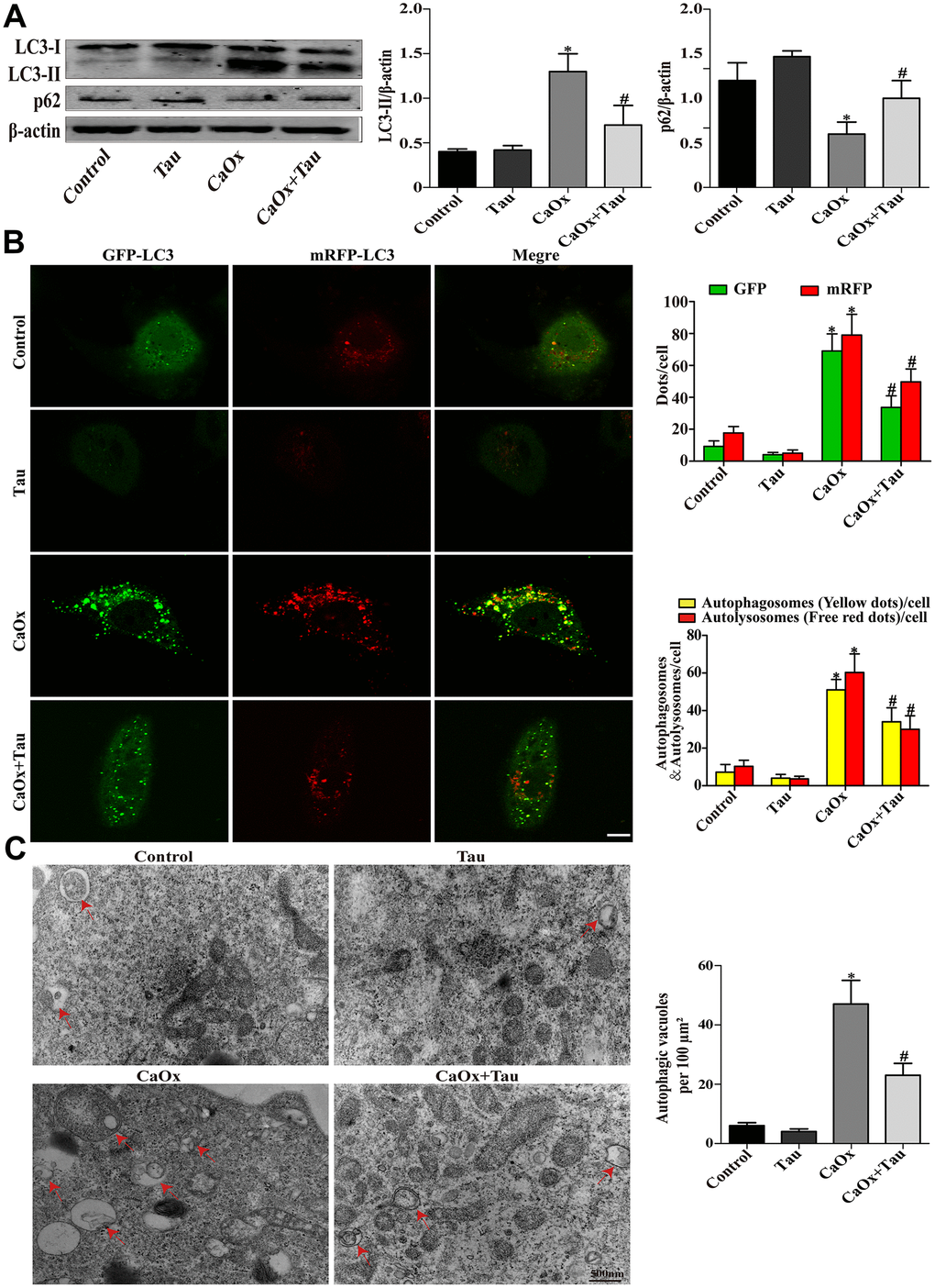 Effects of Tau on CaOx crystals-induced autophagy in cells. (A) The expressions of LC3-II and p62 were assessed by Western blot. (B) Fluorescence microscopy and quantitative analysis of cells transduced with Ad-mRFP-GFP-LC3. The green GFP dots and the red mRFP dots were used to label and track LC3. In the merged image, the yellow dots and the red dots indicate autophagosomes and autolysosomes, respectively; scale bar: 50 μm. (C) Detection of autophagic vacuoles by TEM in HK-2 cells. Red arrows: autophagic vacuoles; scale bar: 500 nm. Data are presented as the mean ± SD (n=3). *P #P 