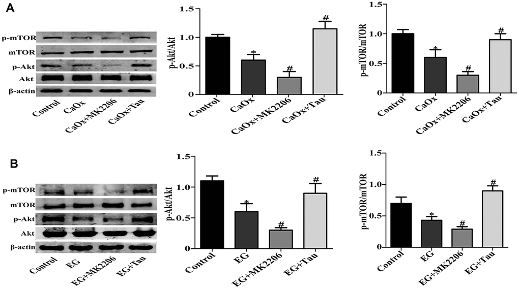 Tau activates Akt/mTOR signaling pathway. (A) The expressions of mTOR, P-mTOR, Akt, and P-Akt in vitro. (B) Representative immunoblot and quantification analysis of mTOR, Akt, P-mTOR, and P-Akt in vivo. Data are presented as the mean ± SD (n=3). *P #P 