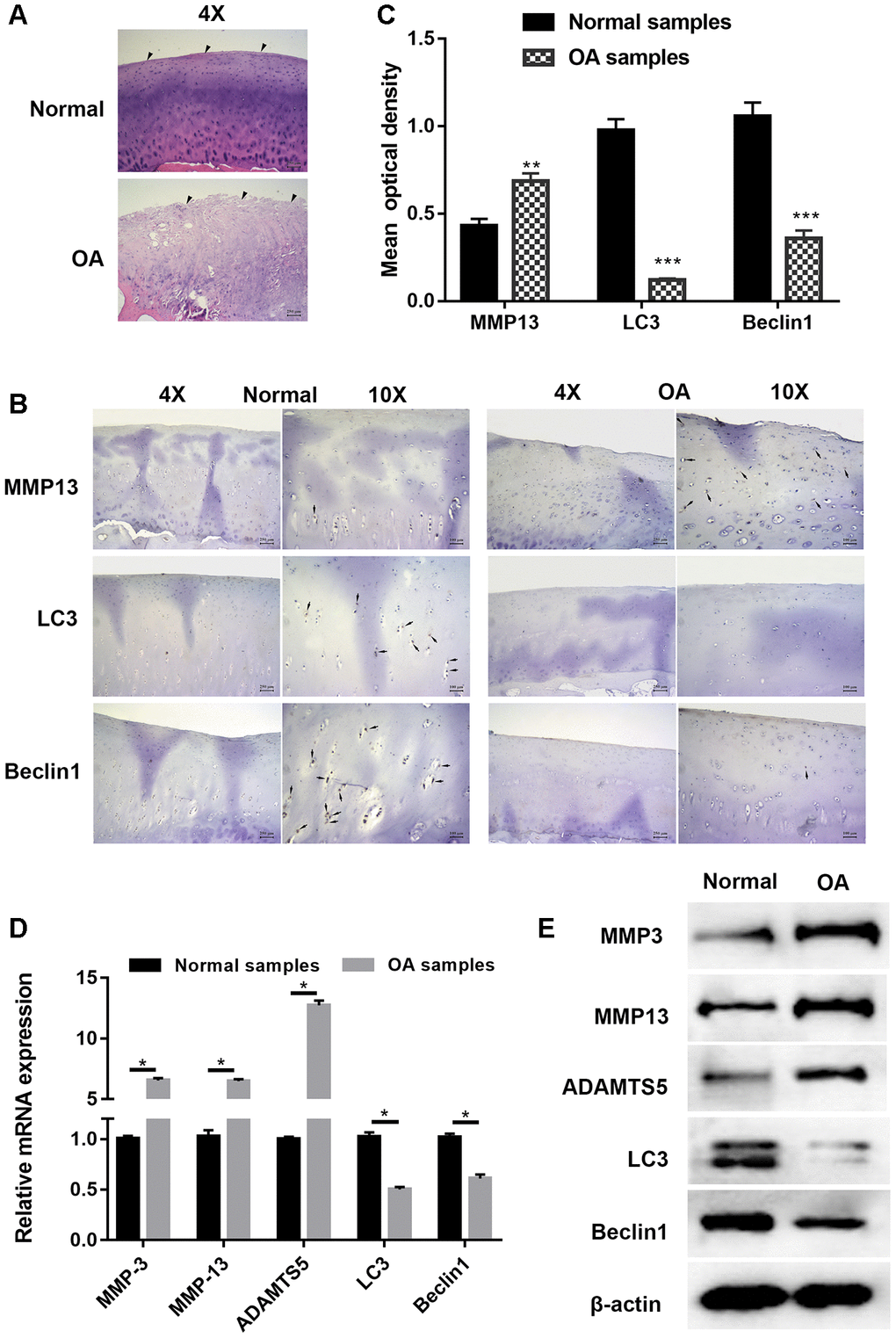 Cartilage degradation and defection of autophagy were validated in osteoarthritis samples. (A) Representative images hematoxylin and eosin (HE) staining; (B) Representative images of immunohistochemistry; (C) Quantitative optical density analysis of immunohistochemistry for samples; (D) mRNA and (E) protein expression of cartilage related proteins (MMP3, MMP13, and ADAMTS5) and autophagy related proteins Beclin1 and LC3. Data represent the mean ± SD (n=6), ** p p 