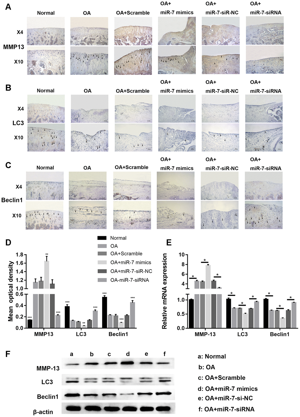 Representative images of immunohistochemical staining for (A) MMP13, (B) LC3, and (C) Bcelin1; (D) Quantitative optical density analysis of immunohistochemical staining for different groups; (E) mRNA and (F) protein expression of MMP13, LC3, and Beclin1. Data represent the mean ± SD (n = 10), ** p p 