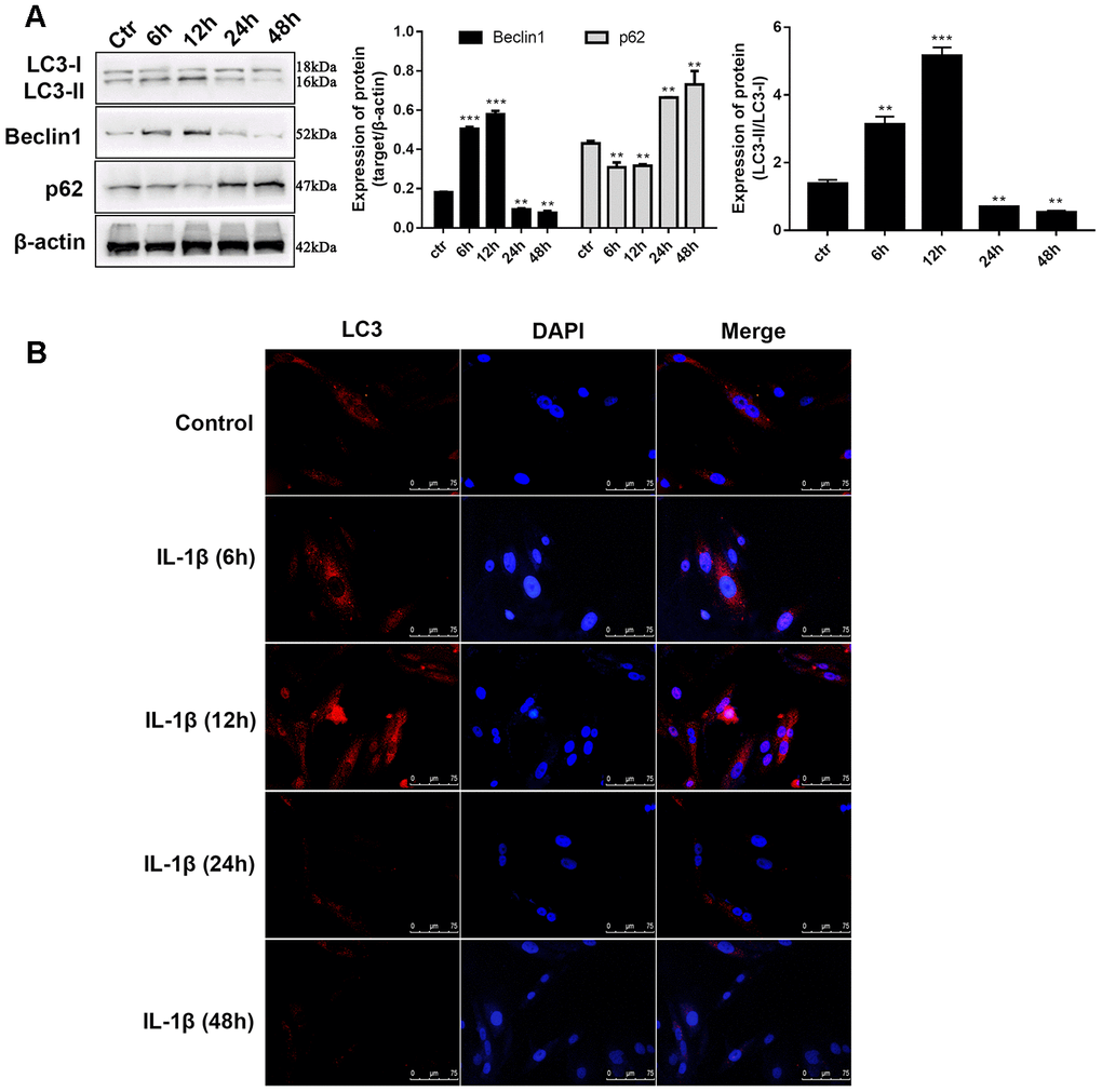 IL-1β exposure induced defection of autophagy in chondrocytes. (A) Western blot analysis of IL-1β-induced chondrocytes at different time points (6, 12, 24, 36, and 48 h) using antibodies directed to LC3, p62, and Beclin1 and normalized to β-actin. Data represent the mean ± SD (n=5), ** p p B) Representative immunofluorescence photomicrograph of LC3 (red)-labelled chondrocytes. Nuclei were stained with DAPI (blue).