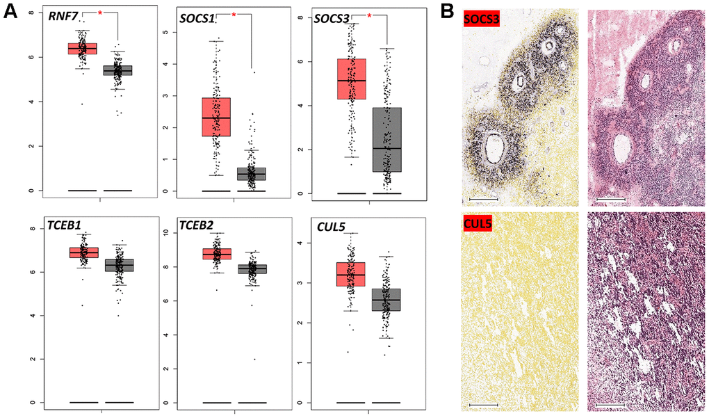 Expression of CRL5 components in GBM. (A) Boxplot data analysis of genes encoding CRL5 components in GBM and normal brain tissues. GEPIA (http://gepia.cancer-pku.cn/) was used to analyze RNA-seq data from malignant and normal tissues (TCGA and GTEx datasets). (B) In situ hybridization of SOCS3 and CUL5 in GBM patients based on the Ivy GAP dataset. * P 