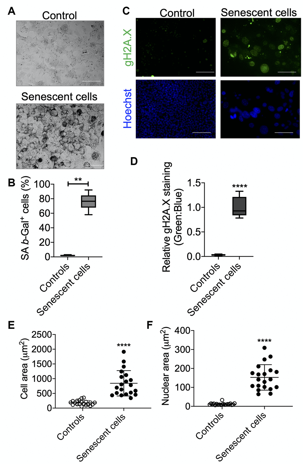 Senescence validation by SA β-Gal and γH2A.X staining. After senescence induction at day 7, cells were re-seeded in 4-chambered slides and next day SA β-Gal (A) and γH2A.X (B) staining were performed. Cells were counted manually for analyzing SA β-Gal+ cells over total cells and presented as percent positive cells. Scale bars as 50 μm. (C) Cells were counter-stained with Hoechst 33324 for immunofluorescence imaging and relative γH2A.X signals were analyzed over Hoechst 33324 signals. Scale bars as 100 μm. (D). (E and F). Area of the cells (E) and nucleus (F) were measured using ImageJ (NIH) software. Statistical differences were calculated significant as *p