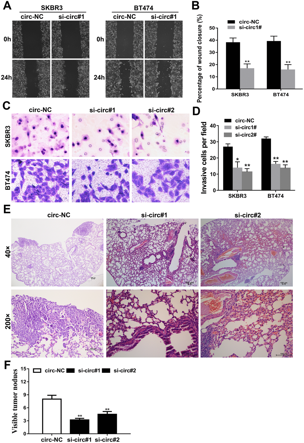 Downregulation of circIQCH inhibits the metastasis of breast cancer cells. (A, B) Wound-healing assays assess the impact of circIQCH on cell migration ability. (C, D) Transwell assays to evaluate cell migration capability. (E) HE-stained sections of lung metastases. (F) The number of metastases was counted and recorded.