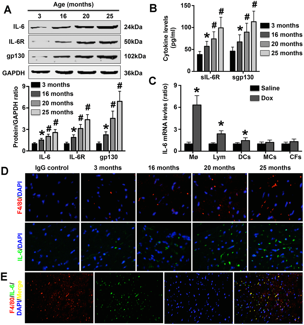 Effect of aging on cardiac IL-6 expression. (A) The expression of IL-6 in mice at 3 months, 15 months, 20 months, and 25 months of age was measured by Western blotting. N=5 in each group. * p# pB) Plasma sIL-6R and sgp130 levels were detected in each group. N=5 in each group. * p# pC) Effects of DOX treatment on IL-6 mRNA expression in WT Møs, lymphocytes, DCs, MCs, and CFs. N=5 in each group. * pD) The cardiac expression of both IL-6 and Mø markers in mice of different ages was detected in 25-month-old mice by immunofluorescence staining. N=5 in each group. (E) Double immunofluorescence staining for anti-F4/80 and anti-IL-6. N=5 in each group.