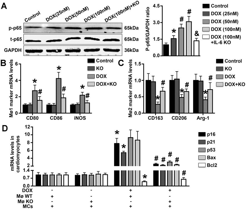 Effects of IL-6 KO on Mø differentiation and MC apoptosis in vitro. (A). The levels of p65 phosphorylation in DOX-treated WT Møs and IL-6 KO Møs were measured. (B, C). The mRNA expression of Mø1- and Mø2-related markers was measured in DOX-treated Møs. (D). The effects of DOX-induced Mø differentiation on MC apoptosis and MC aging were determined by RT-PCR. N=5 in each group. * p# p