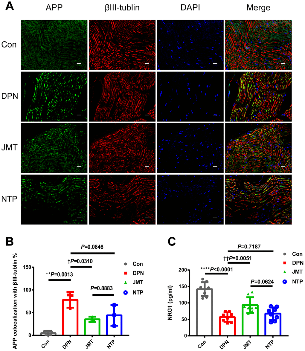 JMT inhibited APP expression and promoted serum NRG1 level in DPN rats. (A) Representative images of longitudinal sections of sciatic nerves with immunolabeling for APP (green), βIII-tubulin (red), and DAPI (blue, marking nuclei) at a magnification of 400×; scale bars, 20 μm. (B) Percentage of APP+ axonal area with βIII-tubulin colocalization. (C) Panels of serum NRG1 level in different groups. Means ± SD; n=3-8/group. ****p p vs. normal control group; ††p p vs. distilled water-treated DPN group. One-way ANOVA followed by Tukey’s multiple comparison test.