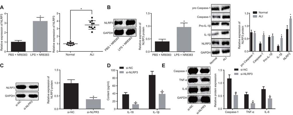 NLRP3 was highly expressed in LPS-induced NR8383 cell and ALI mouse models. NLRP3 expression in NR8383 cells and mice tissues with or without LPS induction assessed by RT-qPCR (N = 10) (A). Levels of NLRP3, pro-caspase-1/caspase-1 and pro-IL-1β/IL-1β normalized to GAPDH in alveolar macrophages (NR8383) of normal mice and mice with ALI evaluated by Western blot analysis (N = 10) (B). Interference efficiency of NLRP3 normalized to GAPDH evaluated by Western blot analysis (N = 10) (C). Levels of cytokines IL-18 and IL-1β detected by ELISA (D). Levels of caspase-1, TNF-α and IL-6 protein normalized to GAPDH in NR8383 cells by Western blot analysis (E). * p vs. PBS + NR8383, normal or si-NC. Measurement data were expressed as mean ± standard deviation. Comparison between two groups was conducted using unpaired t-test. The experiments were repeated three times independently.