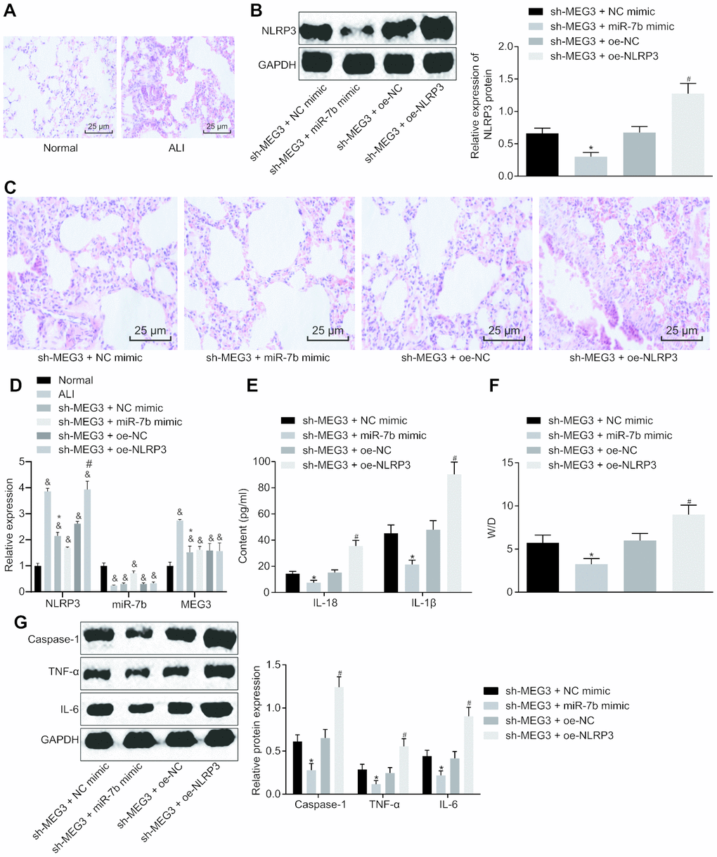 LncRNA MEG3 sponged miR-7b to upregulate NLRP3 to modulate LPS-induced ALI in mice. The pathological changes of lung tissues were observed after the HE staining (× 200) (A, C). The expression of NLRP3 normalized to GAPDH assessed by Western blot analysis (B). The expression of NLRP3, miR-7b and MEG3 in lung tissues of mice following different treatment protocols determined by RT-qPCR (D). The levels of cytokines IL-18 and IL-1β detected by ELISA (E). The pulmonary edema determination of dry weight and wet weight (F). The expression of caspase-1, TNF-α and IL-6 normalized to GAPDH detected by Western blot analysis (G). & p vs. normal; * p vs. si-MEG3 + NC mimic; # p vs. si-MEG3 + oe-NC. Measurement data were expressed as mean ± standard deviation. Data among multiple groups were tested using ANOVA, followed by Tukey’s post hoc test. The experiments were repeated three times independently. N = 10.