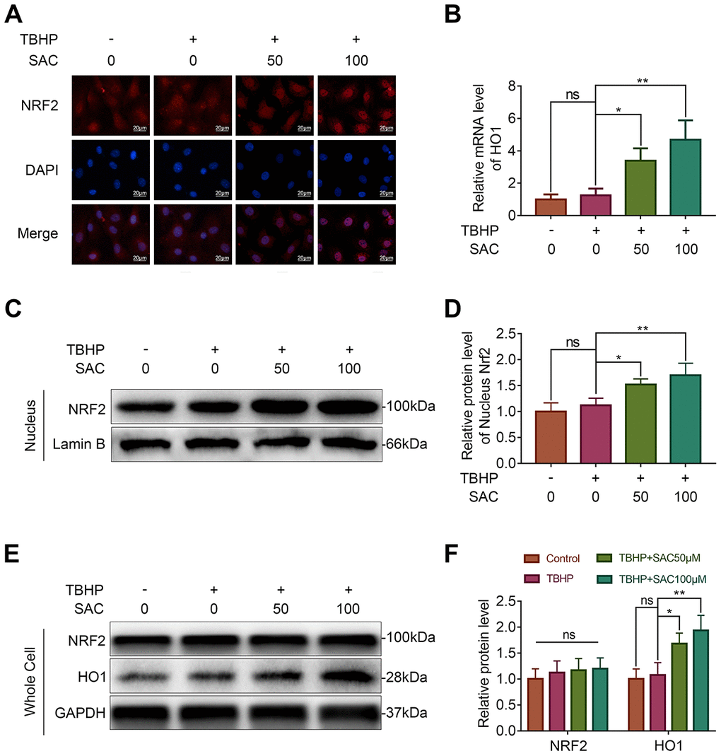 SAC promotes nucleus translocation of Nrf2 and activates the Nrf2/HO1 signaling pathway. (A) Representative immunofluorescence images show Nrf2 expression in the chondrocytes treated with or without SAC for 24 h and 50 μM TBHP for 2 h. The nuclei were stained with DAPI. Scale bar: 20 μm. (B) QRT-PCR analysis shows the HO1 mRNA levels in chondrocytes treated with or without SAC for 24 h and 50 μM TBHP for 2 h. (C) Representative western blot images and (D) Histogram plots show the levels of Nrf2 in the nuclei of chondrocytes treated with or without SAC for 24 h and 50 μM TBHP for 2 h. (E) Representative western blot images and (F) Histogram plots show the Nrf2 and HO1 protein levels in chondrocytes treated with or without SAC for 24 h and 50 μM TBHP for 2 h. Note: The data are presented as the means ± SD of three independent experiments. *p p p 